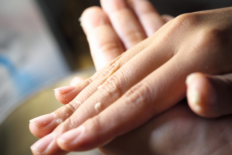 5 maneras en que la piel puede ser señal de problemas de salud