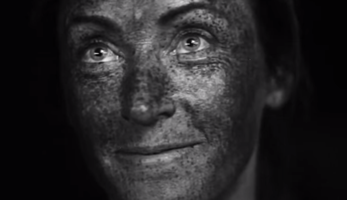 Aunque luzca bien por afuera: Este video revela que tu piel no está tan sana como crees