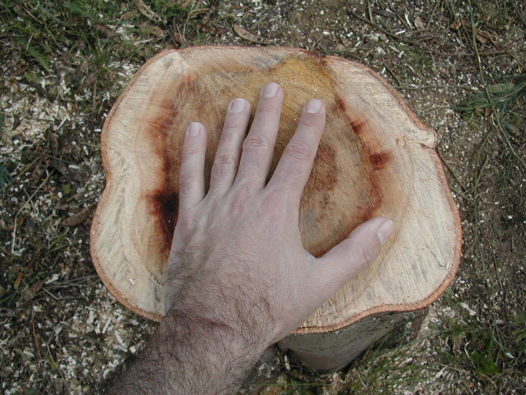 Hombre remata la amputación de su dedo en sitio de ventas por Internet