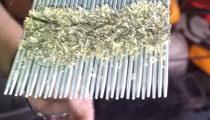 Conmoción mundial genera la pediculosis extrema de una niña chilena