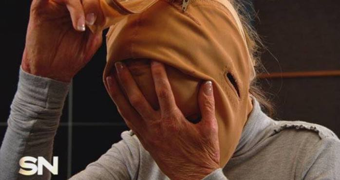 Finalmente la 'mujer sin rostro' mostró su cara al mundo