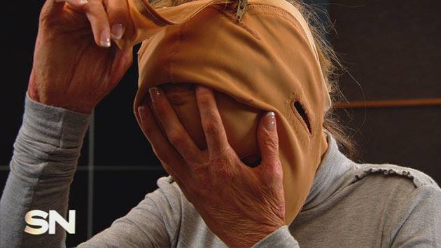 La trágica historia de la mujer sin rostro que vuelve a mostrarse en público