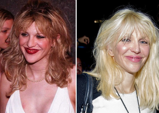 Antes y después: 7 estrellas a las que se les pasó la mano con el botox y las cirugías