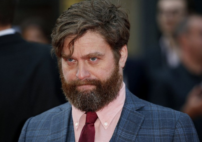 El sorprendente cambio de uno de los protagonistas de “¿Qué pasó ayer?”