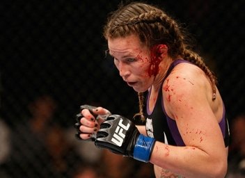 Luchadora de la UFC pierde una oreja tras certero golpe de su rival