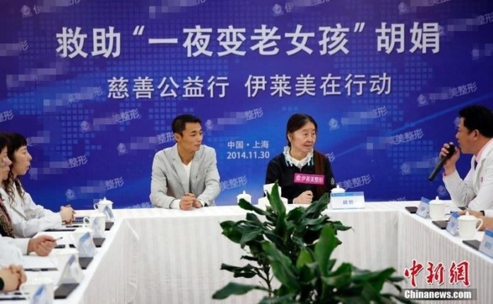 La impactante enfermedad que hace que una joven china de 28 luzca de 60