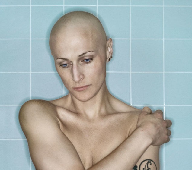 10 crudas imágenes de la lucha de una fotógrafa contra el cáncer de mama