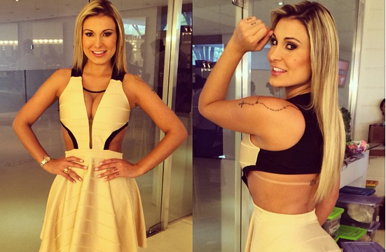 Así quedaron los muslos de la sexy modelo que se inyectó hidrogel: Aún se recupera