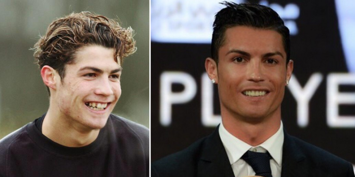 Antes y después: 7 famosos con el síndrome del 