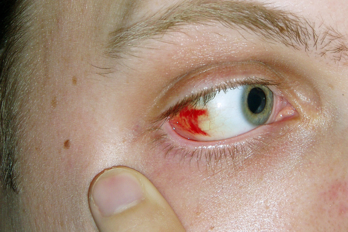 5 aterradores problemas de nuestro cuerpo que resultan ser inofensivos