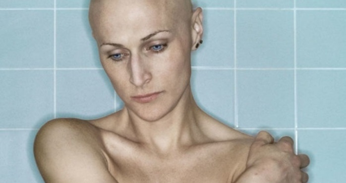 EEUU: Demandan a asociaciones caritativas por estafa masiva a enfermos de cáncer