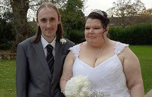 La cirugía que quiere hacerse la 'mujer más celosa del mundo' para no ser abandonada