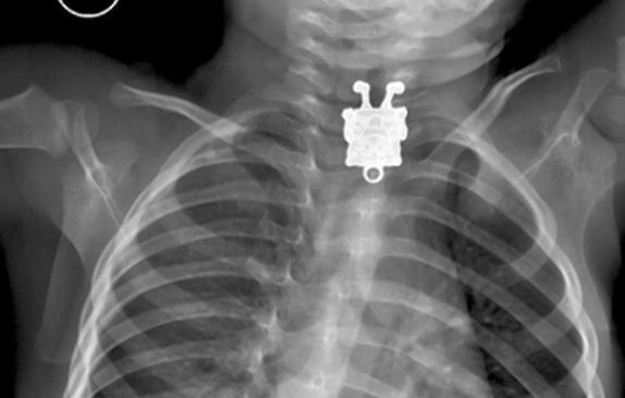 Conoce la divertida web que reúne las radiografías más vergonzosas del mundo