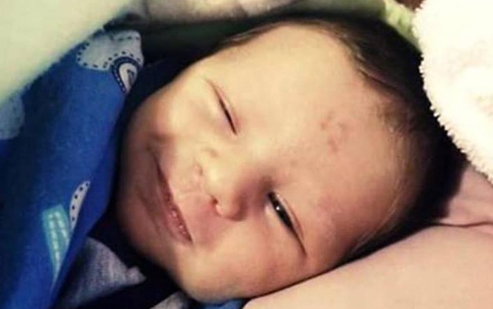 ¡Insólito! Bebé sudafricano nació con un número marcado en su frente