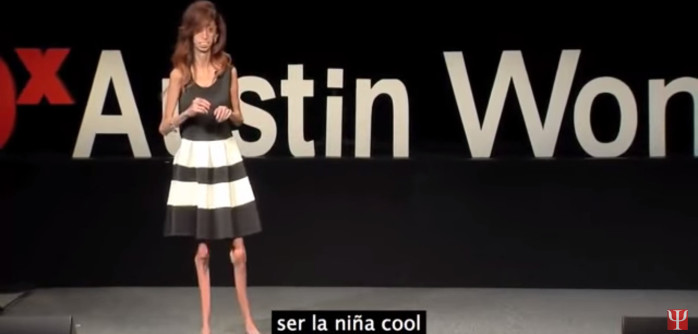 Los conmovedores logros de la mujer declarada como la más fea del mundo