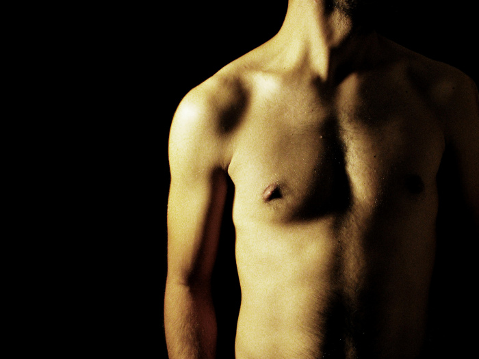 Insólito: Hombre fue al hospital por falla renal y salió sin genitales