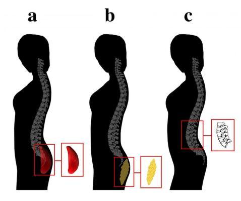 Más que el trasero: Curvatura lumbar femenina sería la principal obsesión masculina