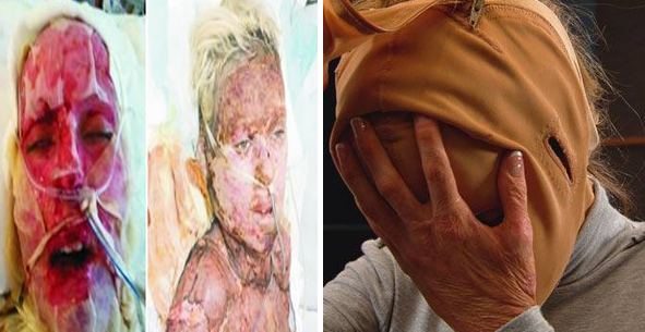 La increíble recuperación de la mujer 