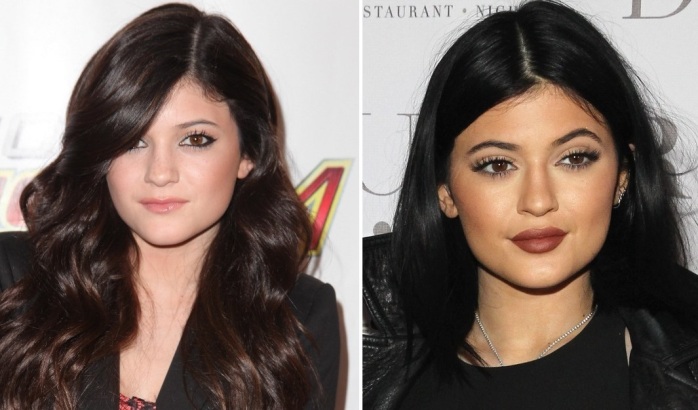 Kylie Jenner se sincera y revela el secreto tras su trasformación: Relleno de labios