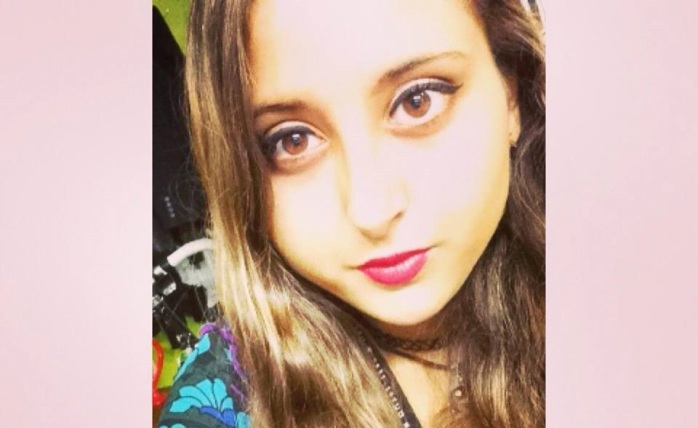 Las crudas fotos de joven inglesa que casi perdió el ojo por un parásito