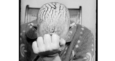 Las escalofriantes fotos del neurocirujano adicto a los cerebros