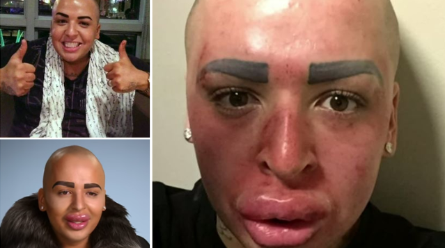 Fanático obsesionado con parecerse a Kim Kardashian revela grave dolencia