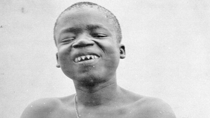 La cruda historia de Ota Benga: El pigmeo que fue exhibido como un animal en EEUU