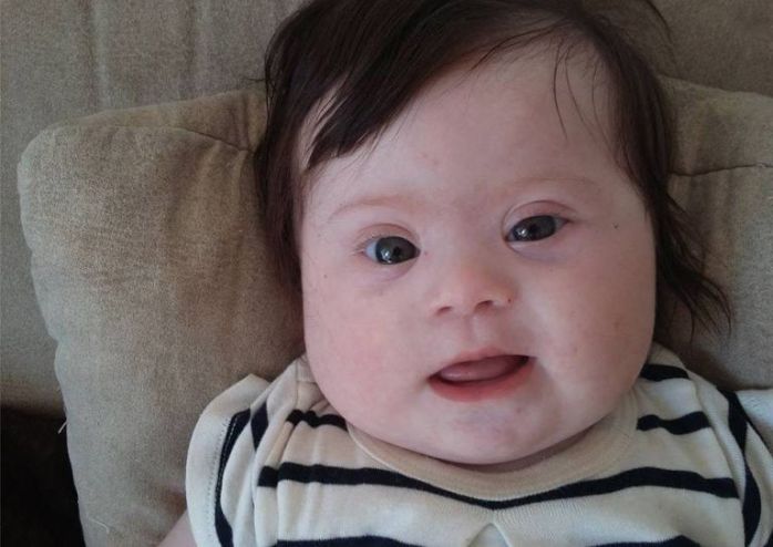 Madre reveló las hirientes frases dichas a su bebé con Síndrome de Down: Ya es viral