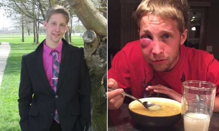 Joven con Asperger sufrió fea golpiza por 