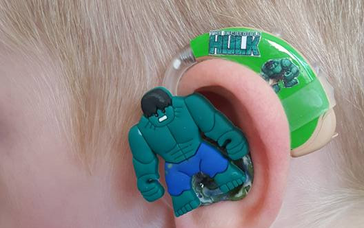 La tierna solución de una madre para que niños sordos usen sus audífonos