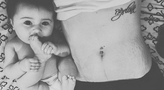 El Instagram que recuerda la belleza tras las estrías femeninas: “Ama tus líneas”