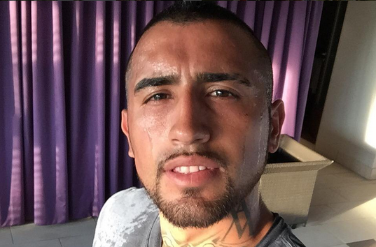 ¿Buena pinta? El inusual traje de Arturo Vidal para sesión de fotos en Alemania