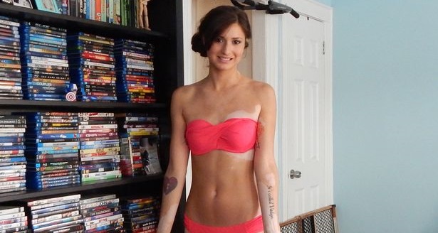 Joven con vitíligo se tatuó una valiente frase para acabar con las miradas