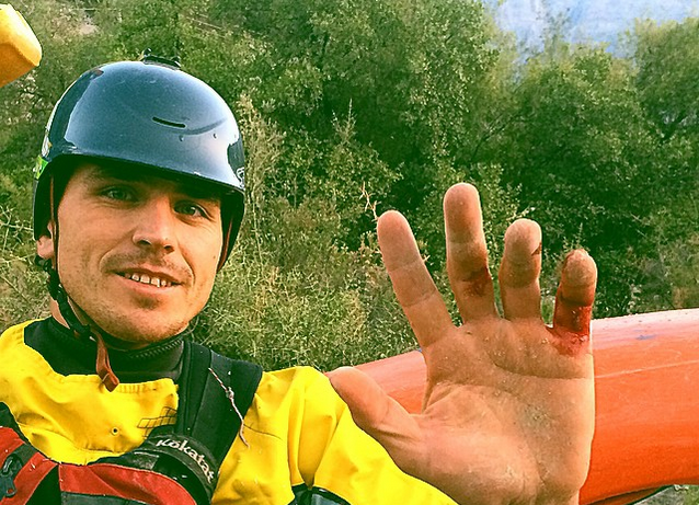 Acusan a Pangal Andrade y a su padre de brutal agresión en Cajón del Maipo