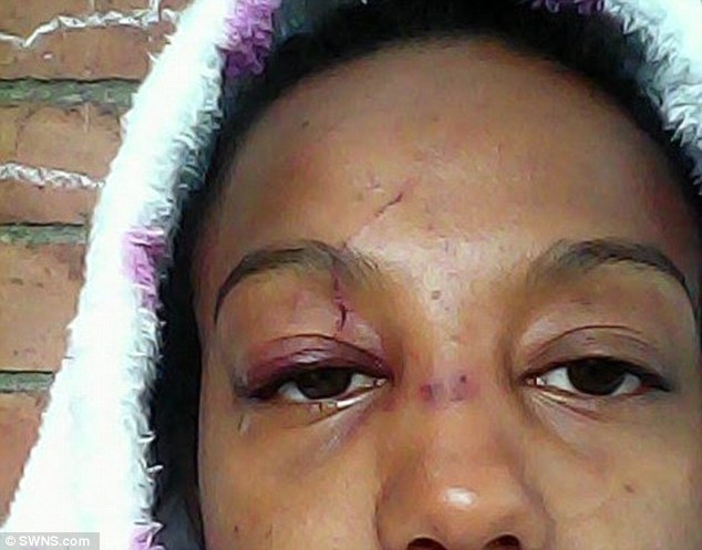 Madre fue brutalmente golpeada afuera de su casa por ser 