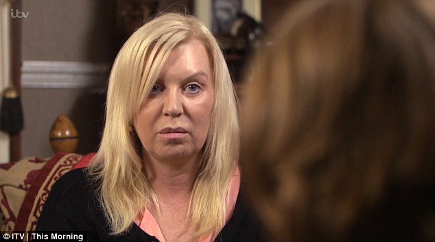 Mujer quiso levantar su rostro con cirugía: Este fue el terrible resultado