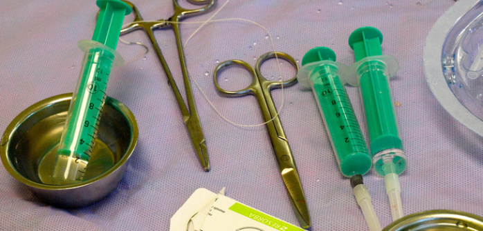 Mujer fue al médico por dolor abdominal: Nunca imaginó lo que tenía adentro