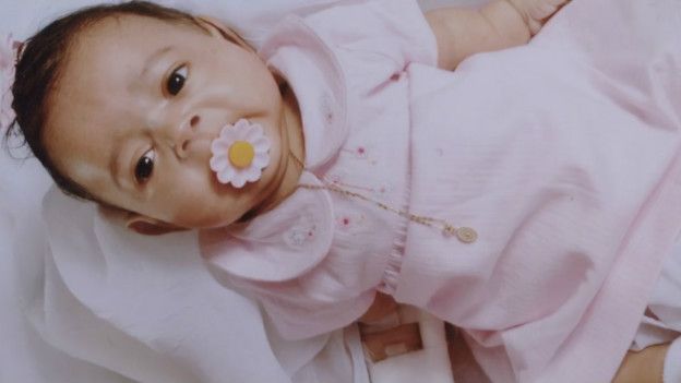 Janelly, la niña que nació sin huesos y que desafió los pronósticos médicos