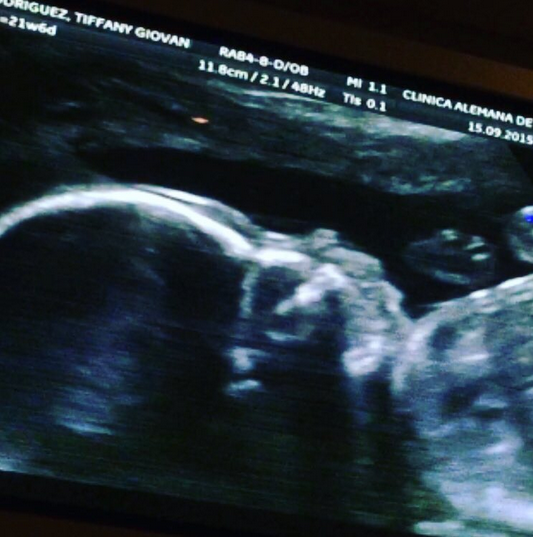 Iván Cabrera | Instagram