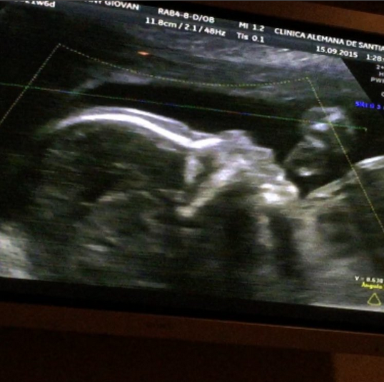 Titi Magrini | Instagram