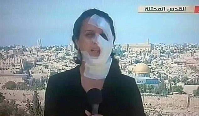 La valiente periodista que siguió al aire a pesar de ser herida por granada