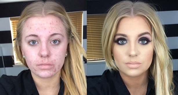 Se burlaron de su “antes y después” y la convirtieron en meme: Así contestó