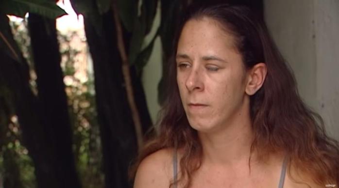 Mujer 'gringa' confundió las gotas para los ojos con otro frasco: Esto pasó