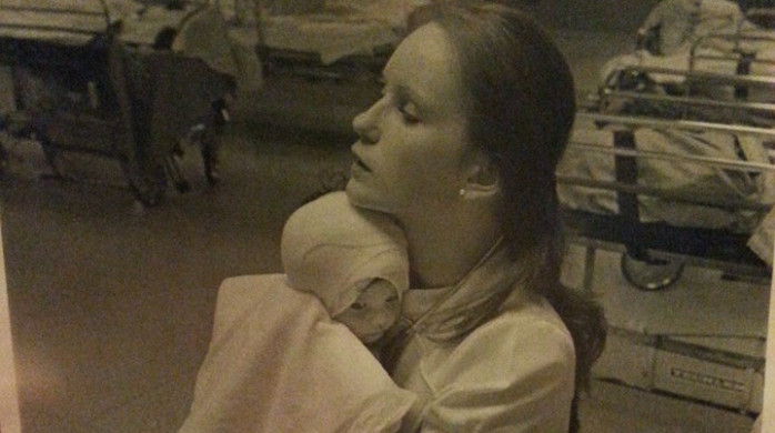 Mujer gravemente quemada siendo una bebé encontró a la enfermera que la cuidó