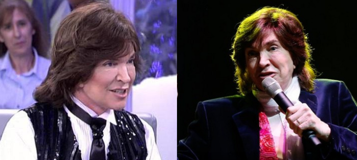 ¿Qué cirugías se hizo Camilo Sesto en su rostro? Esto opinan los expertos