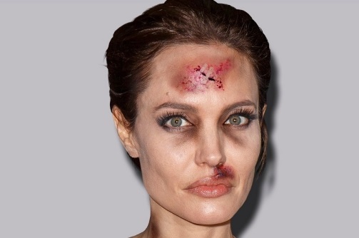 Impactante campaña contra la violencia de género muestra a famosas golpeadas