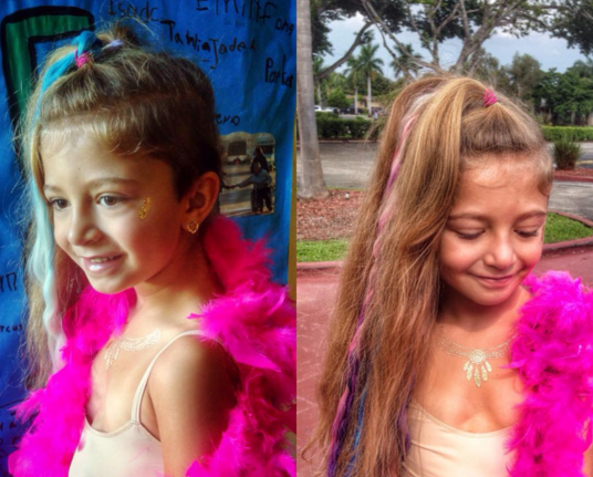 La historia de Virsaviya Borun, la niña que nació con el corazón afuera de su pecho