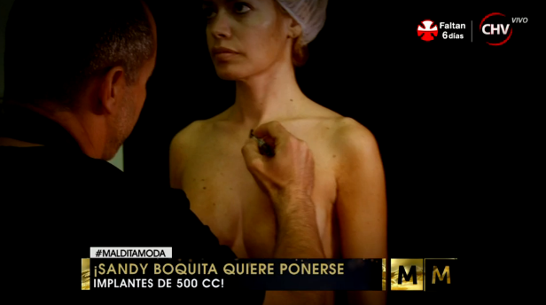 Sandy Boquita cambió sus prótesis mamarias en 