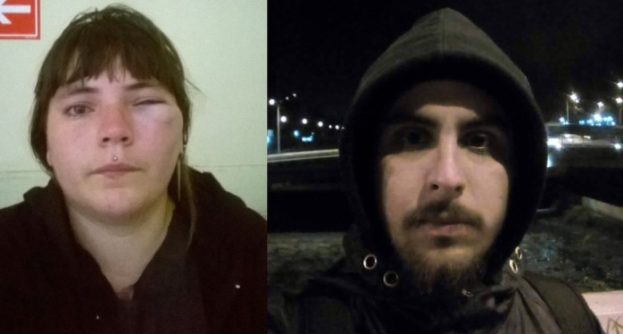 Joven santiaguina denuncia ataque de su ex con crudas fotos de sus lesiones