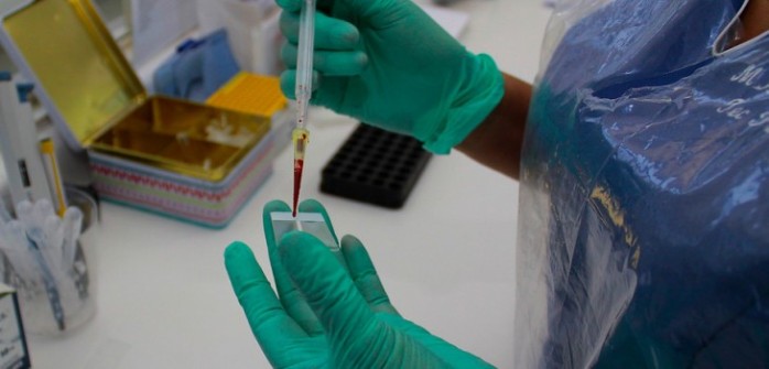 Muere adolescente sospechoso de ser el primer contagiado con Hanta este 2015 en la capital